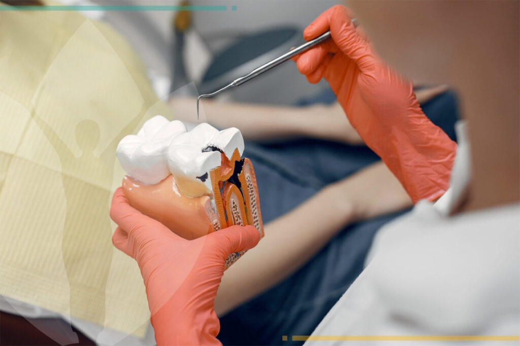 Root Canal Treatment In Turkey