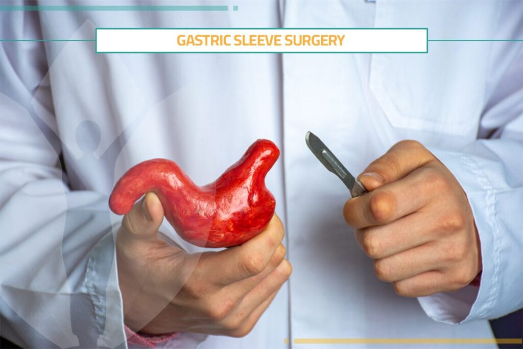 5 Things to Know About Gastric Sleeve Surgery
