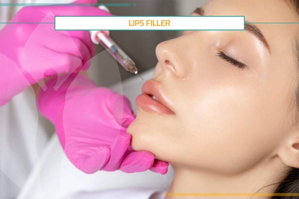Lips Filler Draws Your New Attractive Look