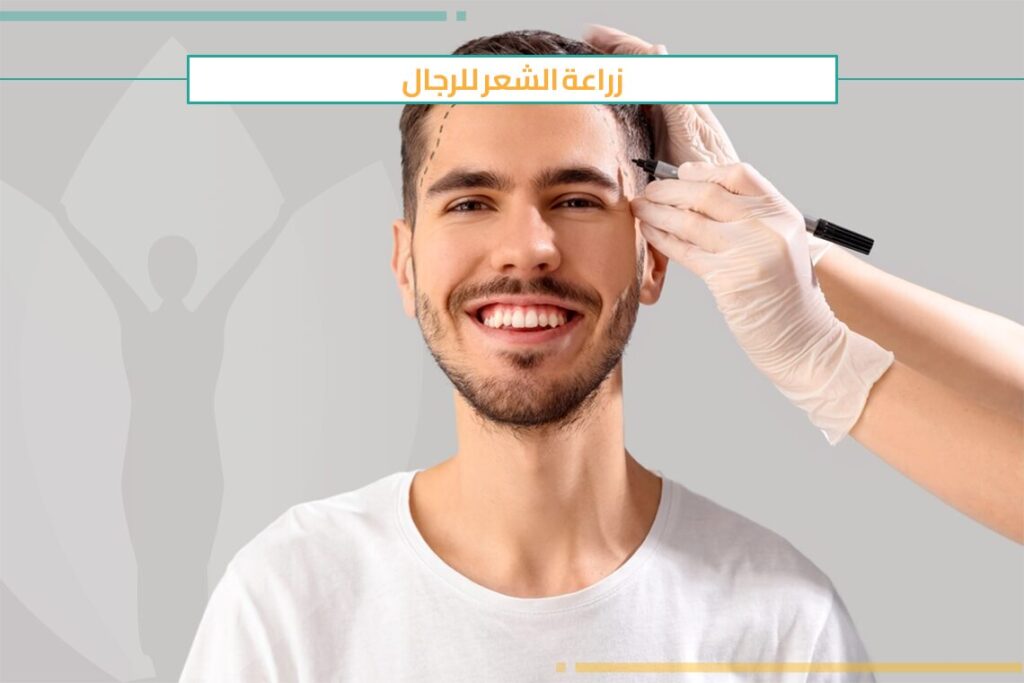 كل ما تحتاج لمعرفته حول زراعة الشعر للرجال