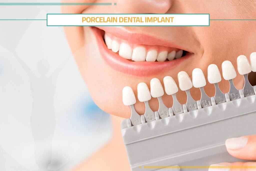 Why Should You Get Porcelain Dental Implant?