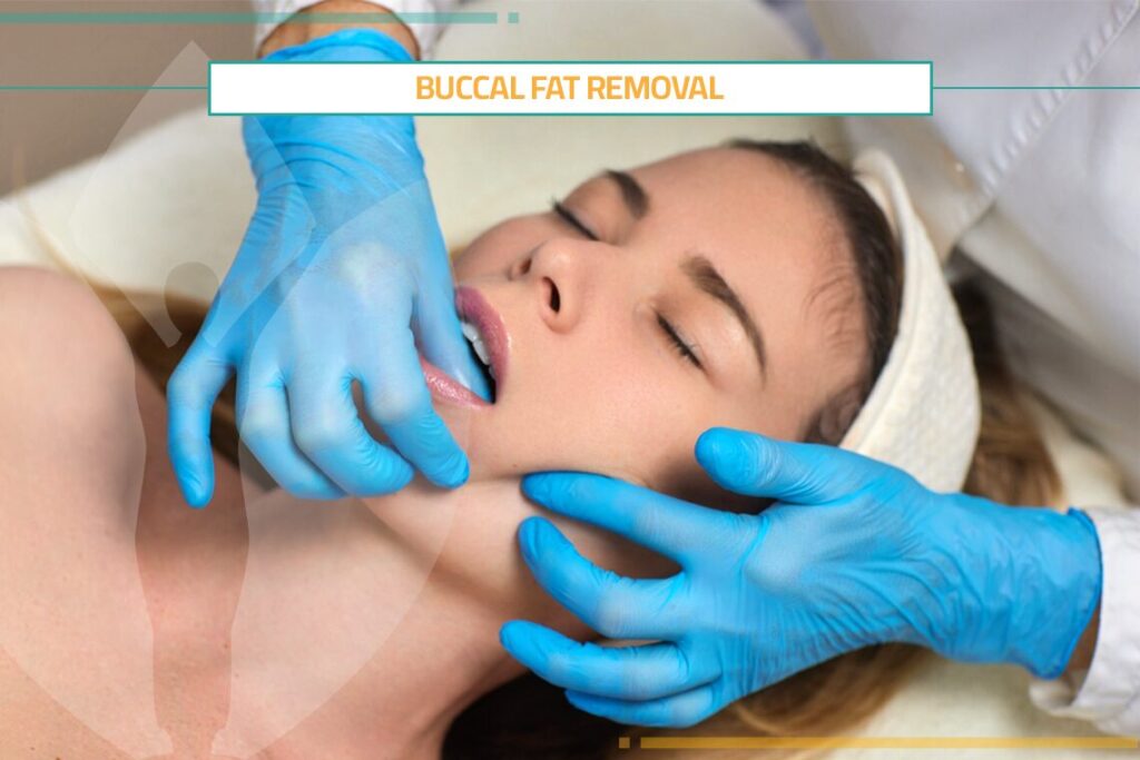 Get 100% Effective Results of Buccal Fat Removal