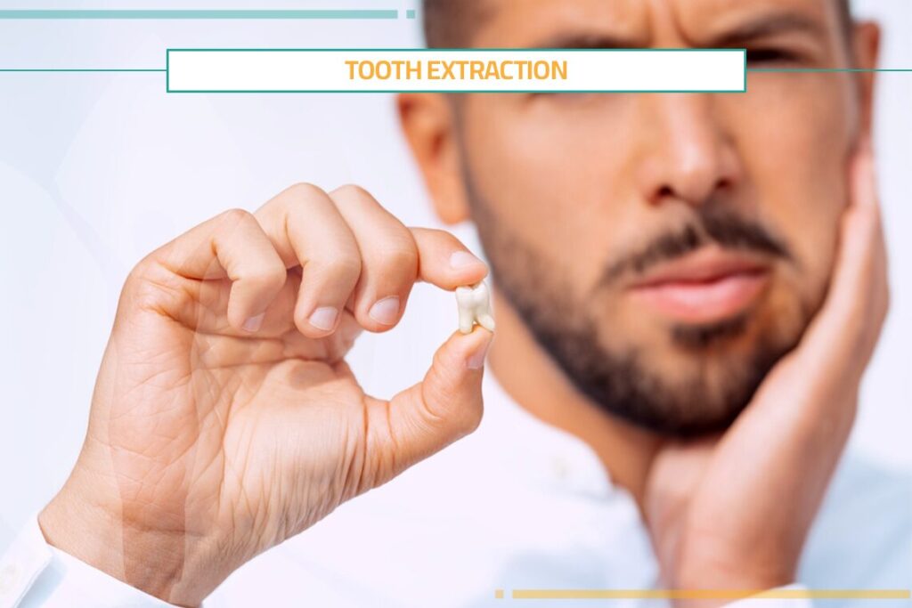 Tooth Extraction: Procedure, Risks & Benefits