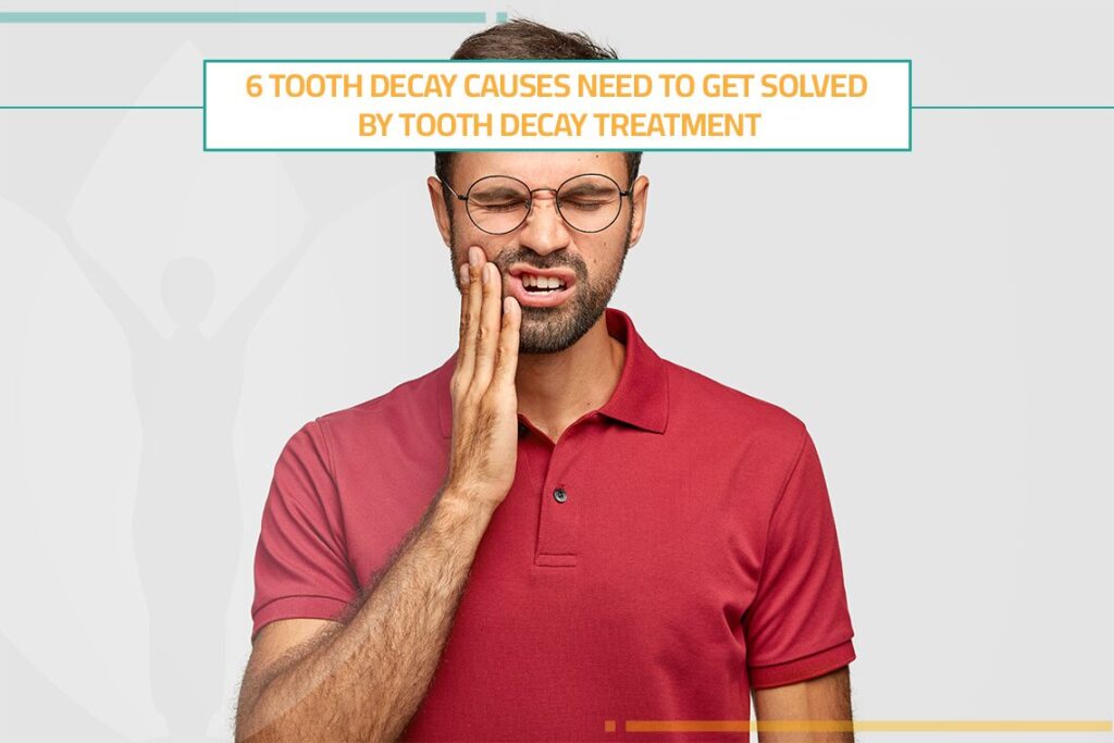 6 Tooth Decay Causes Need to Get Solved by Tooth Decay Treatment