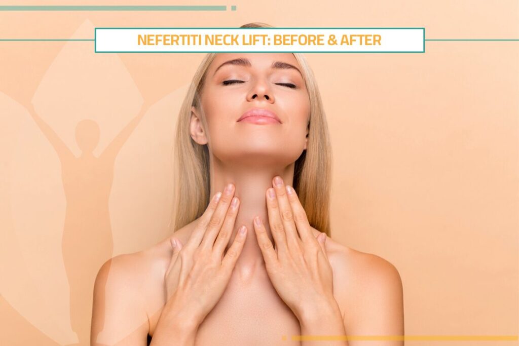 Nefertiti Neck Lift: Before & After