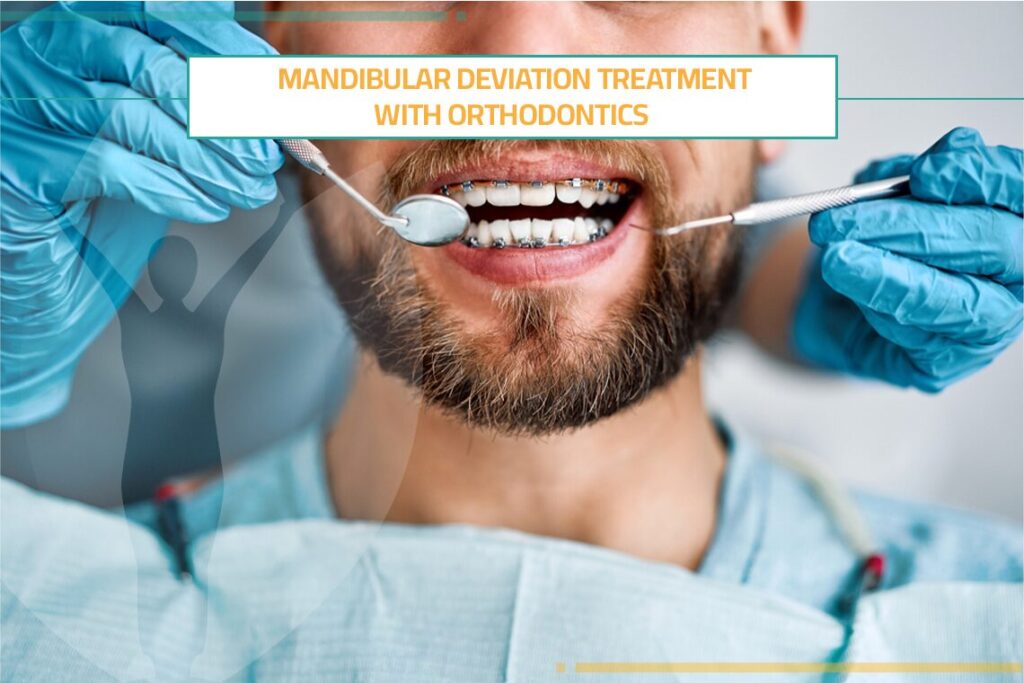 Mandibular Deviation Treatment with Orthodontics