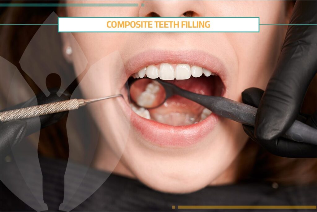 Composite Teeth Filling: Pros, Steps & Costs