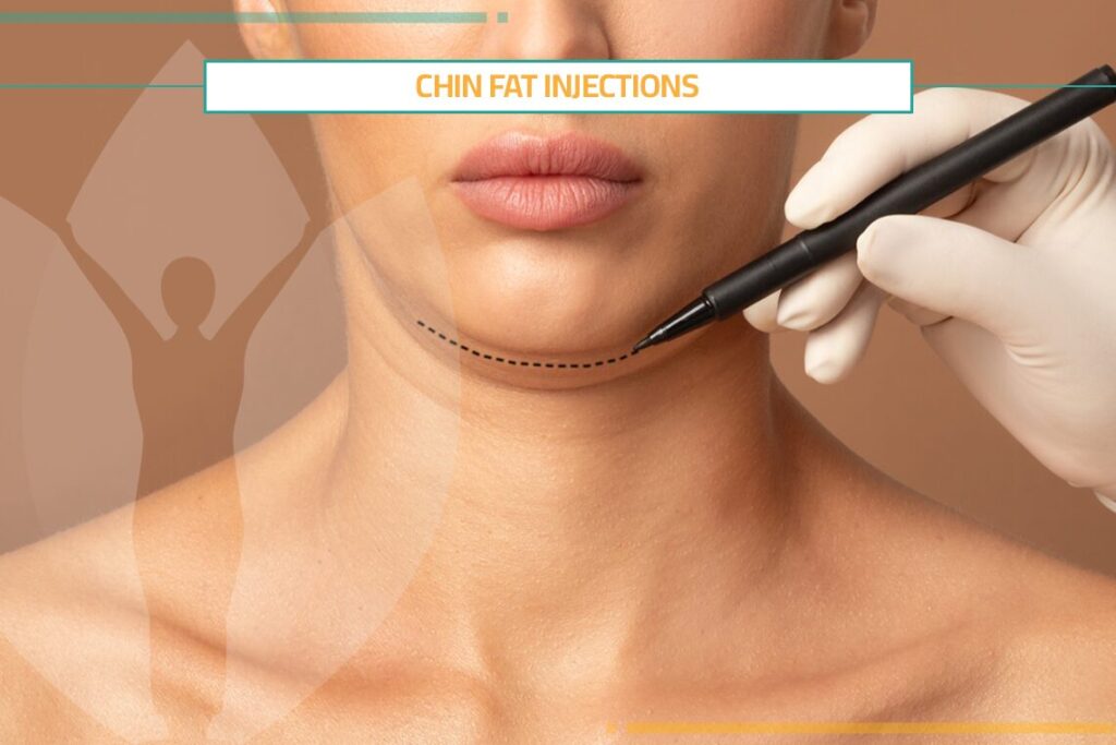 Pros & Cons of Chin Fat Injections