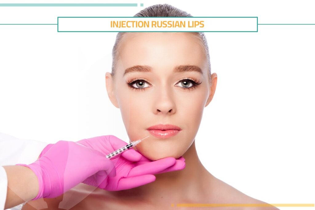 How to Perform Injection Russian Lips?