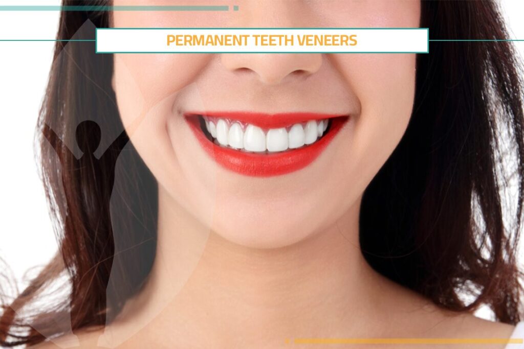 Permanent Teeth Veneers: Procedure & Cost  