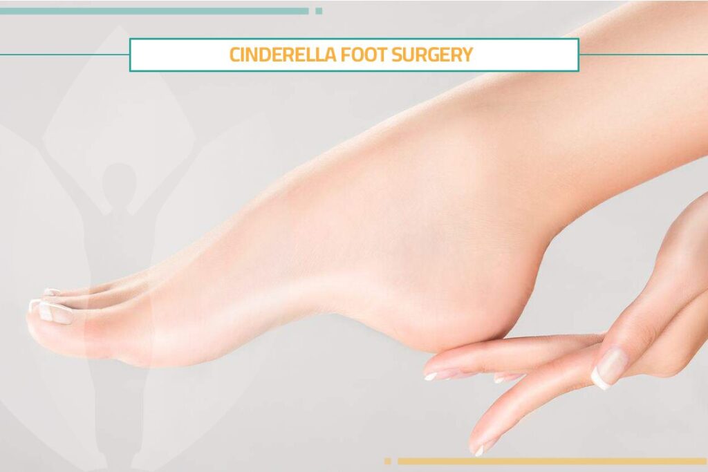 Cinderella Foot Surgery: A Fairy Tale Transformation