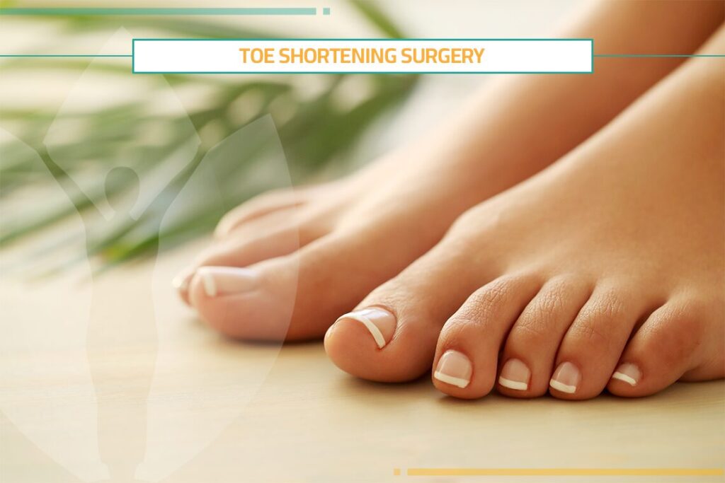 Toe Shortening Surgery: Pros, Cons & Cost