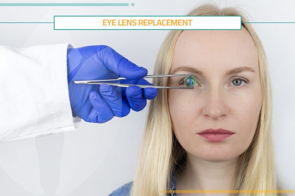 Pros & Cons of Intraocular Lens Implant