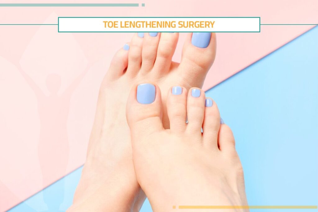 How to Perform Toe Lengthening Surgery?