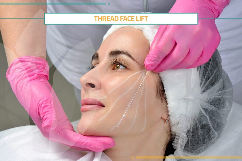 Thread Face Lift: Procedure, Types & Cost