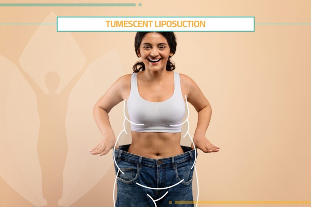 Check the Results of Tumescent Liposuction Before and After