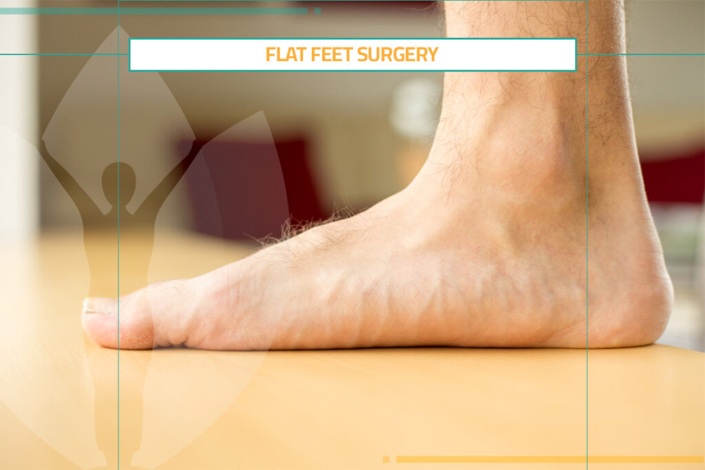 How to Perform Flat Foot Correction?