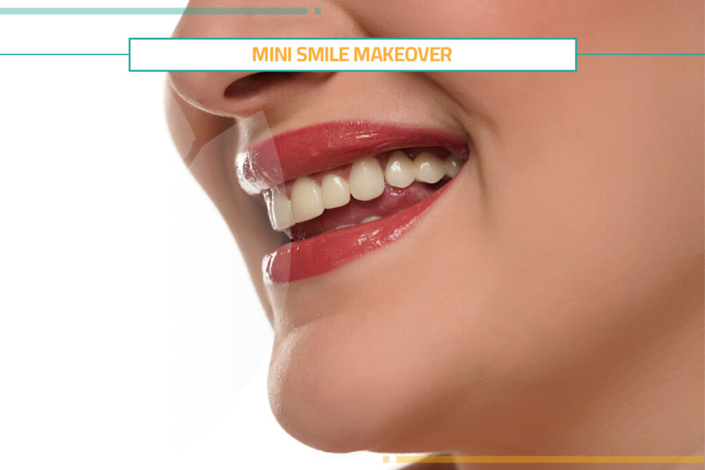 Book Free Consultation to Perform Mini Smile Makeover