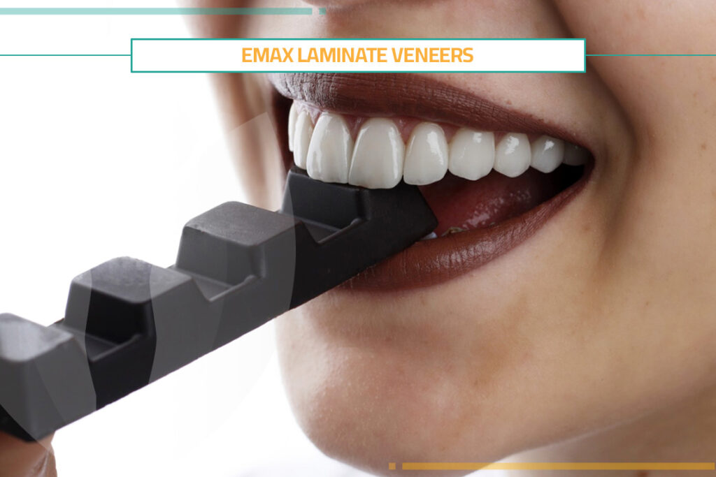 How Can You Get Emax Laminate Veneers?