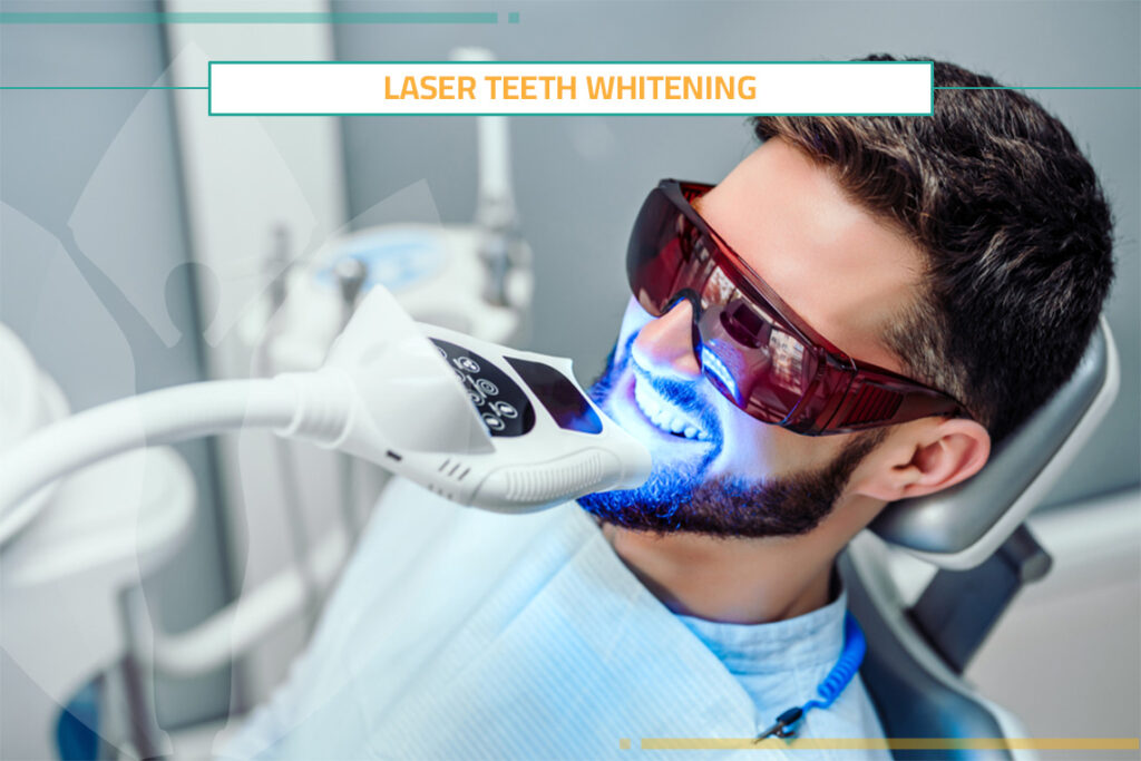 5 FAQ`s about Laser Teeth Whitening