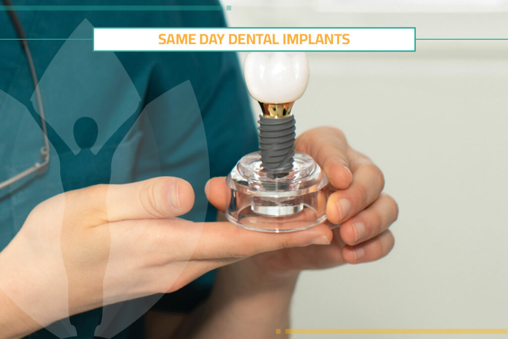 Is It Good to Perform Same Day Dental Implants?