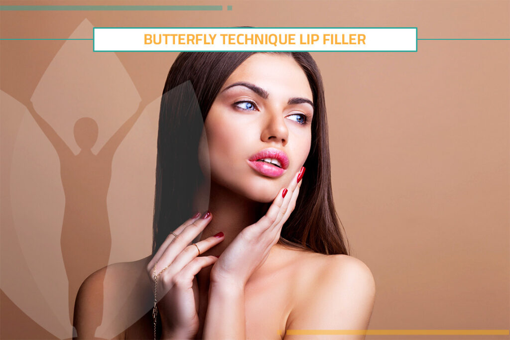 Have You Heard about the Trend of Butterfly Lips Filler?